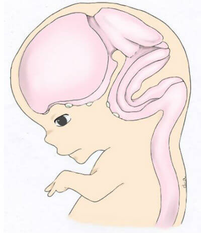 妊娠3～4ヶ月頃の胎児2